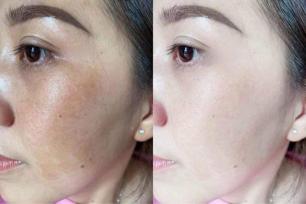 Viện thẩm mỹ trị nám