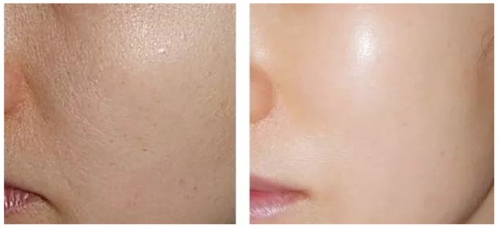 điều trị chăm sóc da chuyên sâu