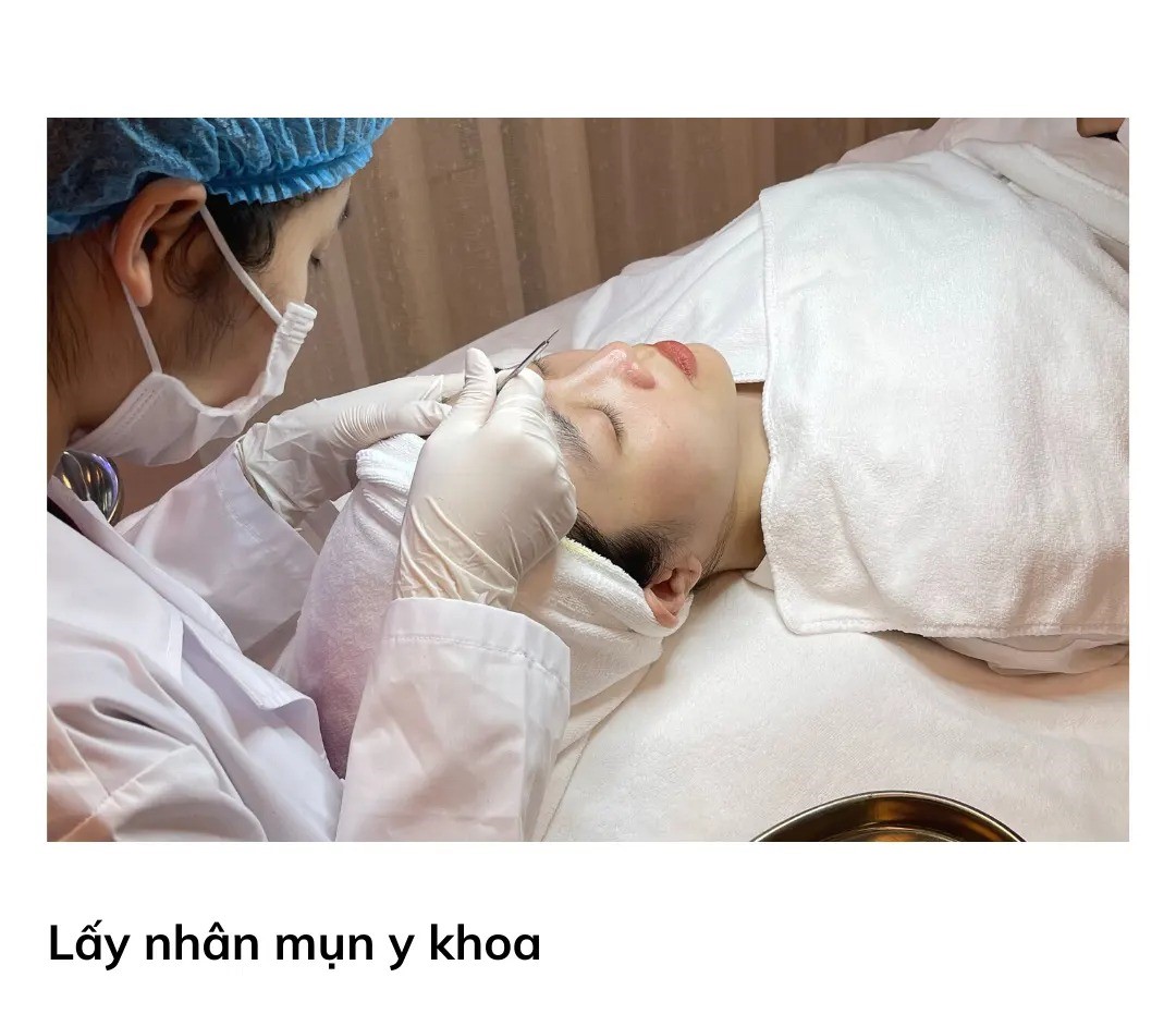 Lấy nhân mụn chuẩn y khoa