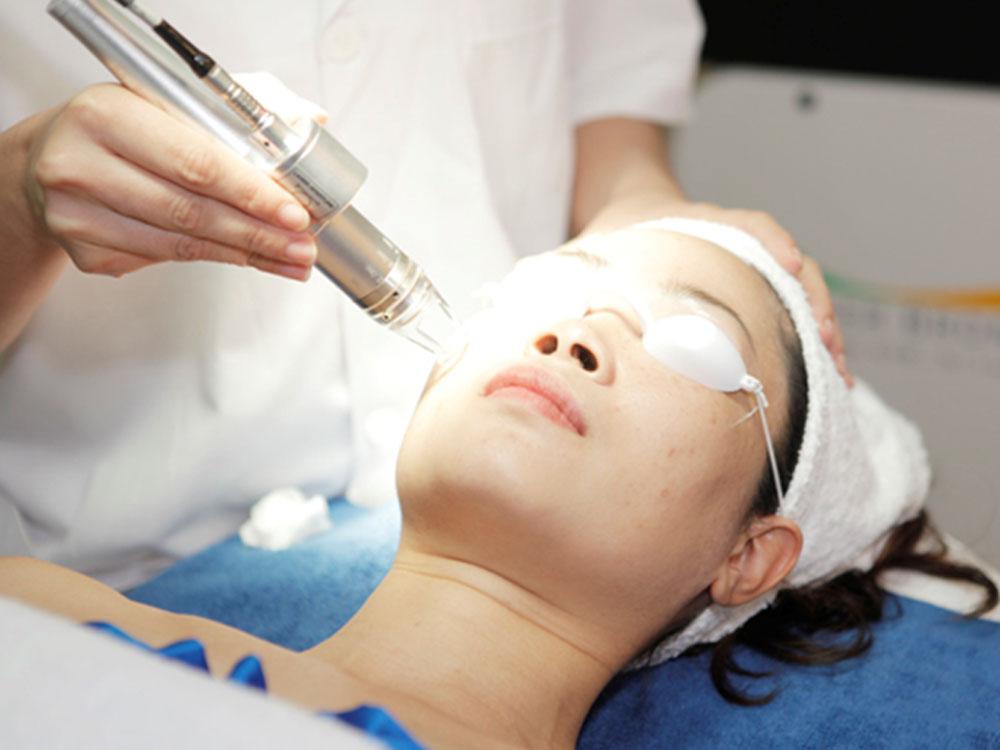 Địa chỉ phi kim trị sẹo rỗ an toàn hiệu quả