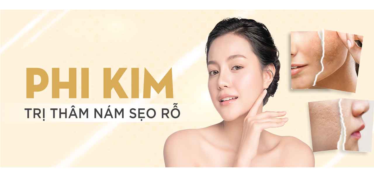 viện thẩm mỹ KWAN - Địa chỉ phi kim trị sẹo rỗ an toàn hiệu quả