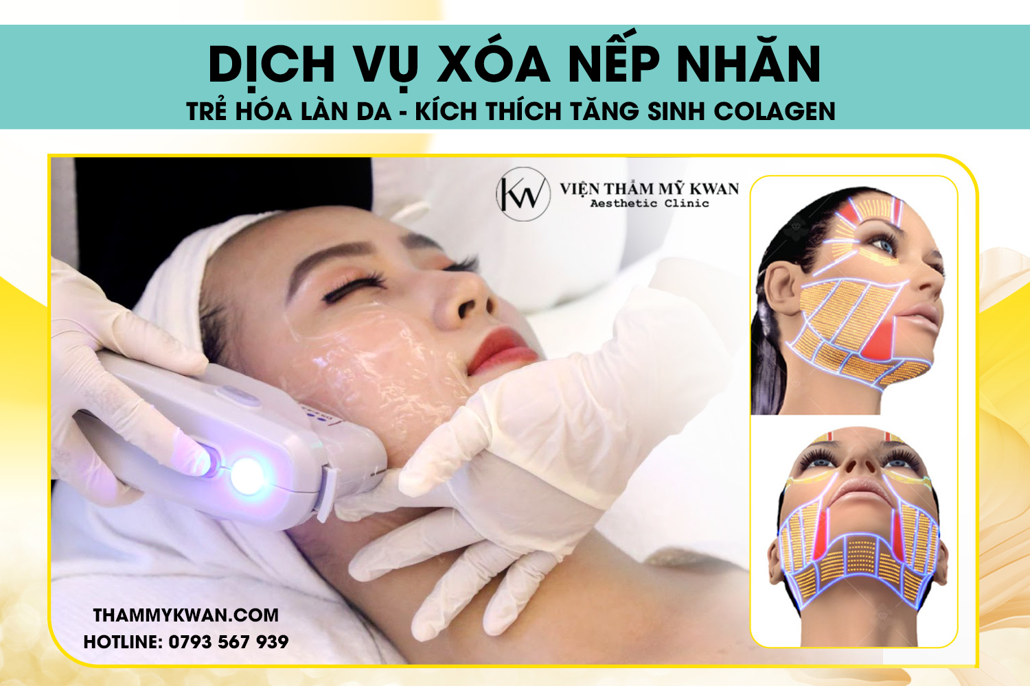 xóa nếp nhăn